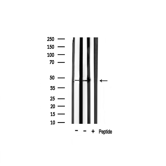 F2R / Thrombin Receptor / PAR1 Antibody - Western blot analysis of extracts of various samples using Thrombin Receptor antibody.