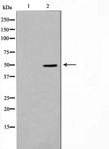 F2R / Thrombin Receptor / PAR1 Antibody - Western blot analysis on HeLa cell lysates using Thrombin Receptor antibody. The lane on the left is treated with the antigen-specific peptide.