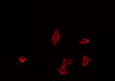 F2R / Thrombin Receptor / PAR1 Antibody - Staining HeLa cells by IF/ICC. The samples were fixed with PFA and permeabilized in 0.1% Triton X-100, then blocked in 10% serum for 45 min at 25°C. The primary antibody was diluted at 1:200 and incubated with the sample for 1 hour at 37°C. An Alexa Fluor 594 conjugated goat anti-rabbit IgG (H+L) Ab, diluted at 1/600, was used as the secondary antibody.