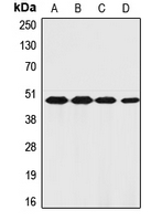 F2R / Thrombin Receptor / PAR1 Antibody - Western blot analysis of PAR1 expression in PaCa2 (A); HeLa (B); TF1 (C); ECV304 (D) whole cell lysates.