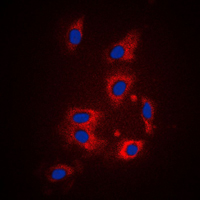 F2R / Thrombin Receptor / PAR1 Antibody - Immunofluorescent analysis of PAR1 staining in HeLa cells. Formalin-fixed cells were permeabilized with 0.1% Triton X-100 in TBS for 5-10 minutes and blocked with 3% BSA-PBS for 30 minutes at room temperature. Cells were probed with the primary antibody in 3% BSA-PBS and incubated overnight at 4 C in a humidified chamber. Cells were washed with PBST and incubated with a DyLight 594-conjugated secondary antibody (red) in PBS at room temperature in the dark. DAPI was used to stain the cell nuclei (blue).