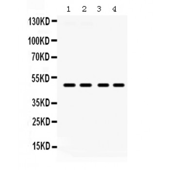 F2RL1 / PAR2 Antibody - PAR2 antibody Western blot. All lanes: Anti PAR2 at 0.5 ug/ml. Lane 1: HELA Whole Cell Lysate at 40 ug. Lane 2: COLO320 Whole Cell Lysate at 40 ug. Lane 3: SW620 Whole Cell Lysate at 40 ug. Lane 4: HEPG2 Whole Cell Lysate at 40 ug. Predicted band size: 49 kD. Observed band size: 49 kD.