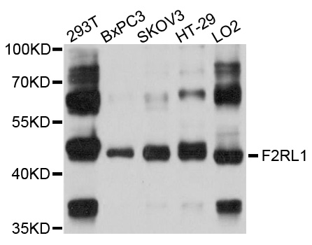 F2RL1 / PAR2 Antibody - Western blot analysis of extracts of various cell lines.