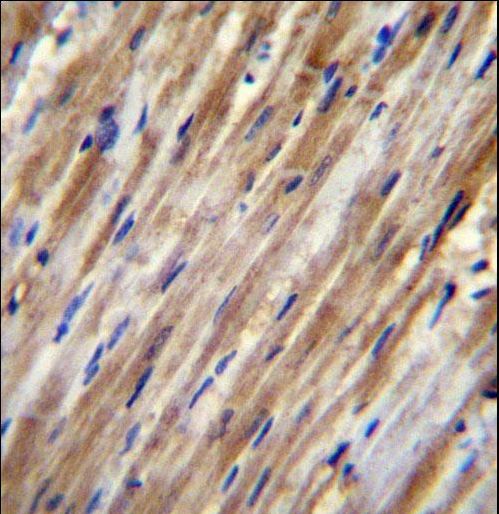 F2RL2 / PAR3 Antibody - F2RL2 Antibody immunohistochemistry of formalin-fixed and paraffin-embedded human heart tissue followed by peroxidase-conjugated secondary antibody and DAB staining.