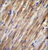 F2RL2 / PAR3 Antibody - F2RL2 Antibody immunohistochemistry of formalin-fixed and paraffin-embedded human heart tissue followed by peroxidase-conjugated secondary antibody and DAB staining.