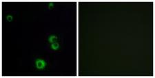 F2RL2 / PAR3 Antibody - Immunofluorescence analysis of MCF7 cells, using F2RL2 Antibody. The picture on the right is blocked with the synthesized peptide.