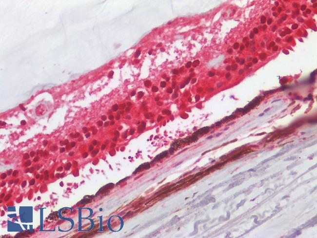 F2RL2 / PAR3 Antibody - Human Eye, Retina: Formalin-Fixed, Paraffin-Embedded (FFPE)
