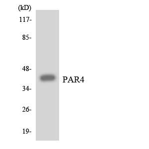 F2RL3 / PAR4 Antibody - Western blot analysis of the lysates from HT-29 cells using PAR4 antibody.
