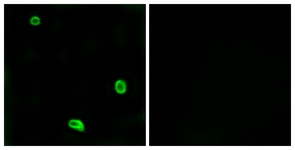 F2RL3 / PAR4 Antibody - Immunofluorescence of LOVO cells, using PAR4 Antibody. The picture on the right is treated with the synthesized peptide.