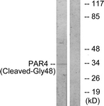 F2RL3 / PAR4 Antibody - Western blot of extracts from NIH-3T3 cells, treated with etoposide 25 uM 1h, using PAR4 (Cleaved-Gly48) Antibody. The lane on the right is treated with the synthesized peptide.