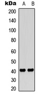 F2RL3 / PAR4 Antibody - Western blot analysis of PAR4 expression in HeLa (A); THP1 (B) whole cell lysates.