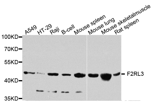 F2RL3 / PAR4 Antibody - Western blot analysis of extracts of various cells.