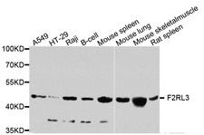 F2RL3 / PAR4 Antibody - Western blot analysis of extracts of various cells.