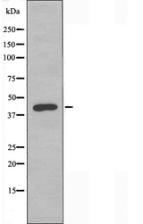 F2RL3 / PAR4 Antibody - Western blot analysis of extracts of HeLa cells using PAR4 antibody.