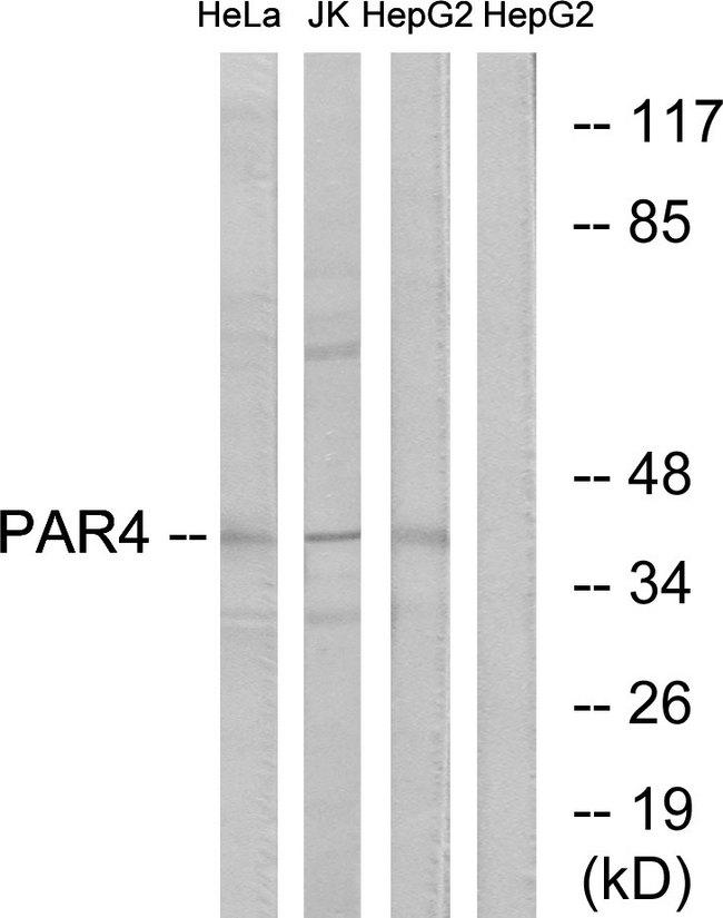 F2RL3 / PAR4 Antibody - Western blot analysis of extracts from HeLa cells, Jurkat cells and HepG2 cells, using PAR4 antibody.