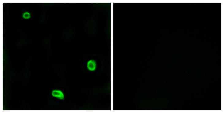 F2RL3 / PAR4 Antibody - Peptide - + Immunofluorescence analysis of LOVO cells, using PAR4 antibody.