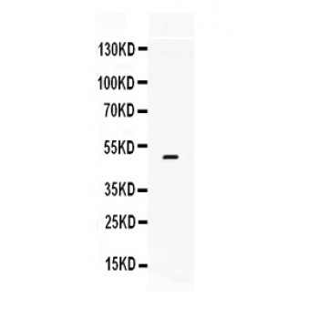 F3 / CD142 / Tissue factor Antibody - Tissue Factor antibody Western blot. All lanes: Anti Tissue Factor at 0.5 ug/ml. WB: Mouse Lung Tissue Lysate at 50 ug. Predicted band size: 50 kD. Observed band size: 50 kD.
