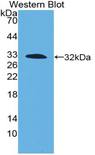 F3 / CD142 / Tissue factor Antibody