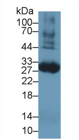 F3 / CD142 / Tissue factor Antibody - Western Blot; Sample: Rat Blood Cells lysate; Primary Ab: 1µg/ml Rabbit Anti-Rat TF Antibody Second Ab: 0.2µg/mL HRP-Linked Caprine Anti-Rabbit IgG Polyclonal Antibody