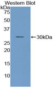 F3 / CD142 / Tissue factor Antibody - Western Blot; Sample: Recombinant protein.