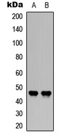 F3 / CD142 / Tissue factor Antibody - Western blot analysis of CD142 (pS290) expression in human kidney (A); human brain (B) whole cell lysates.