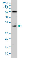 F3 / CD142 / Tissue factor Antibody - F3 monoclonal antibody (M01), clone 4G4 Western Blot analysis of F3 expression in A-431.