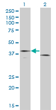 F3 / CD142 / Tissue factor Antibody - Western Blot analysis of F3 expression in transfected 293T cell line by F3 monoclonal antibody (M01), clone 4G4.Lane 1: F3 transfected lysate(33.1 KDa).Lane 2: Non-transfected lysate.