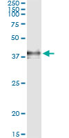 F3 / CD142 / Tissue factor Antibody - Immunoprecipitation of F3 transfected lysate using anti-F3 monoclonal antibody and Protein A Magnetic Bead, and immunoblotted with F3 rabbit polyclonal antibody.