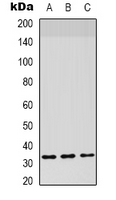 F3 / CD142 / Tissue factor Antibody - Western blot analysis of CD142 expression in HepG2 (A); mouse lung (B) whole cell lysates.