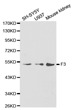 F3 / CD142 / Tissue factor Antibody - Western blot analysis of extracts of various cell lines, using F3 antibody.