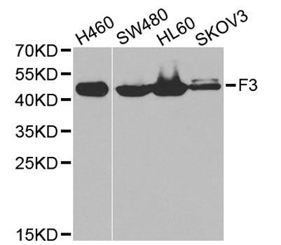F3 / CD142 / Tissue factor Antibody - Western blot analysis of extracts of various cell lines, using F3 antibody at 1:1000 dilution. The secondary antibody used was an HRP Goat Anti-Rabbit IgG (H+L) at 1:10000 dilution. Lysates were loaded 25ug per lane and 3% nonfat dry milk in TBST was used for blocking. An ECL Kit was used for detection and the exposure time was 10s.