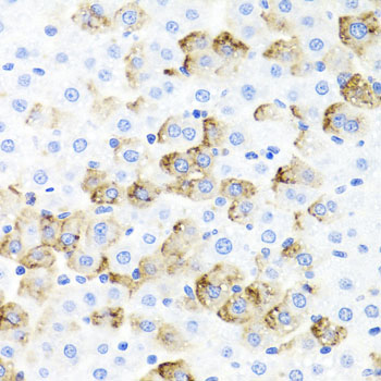 F3 / CD142 / Tissue factor Antibody - Immunohistochemistry of paraffin-embedded rat liver using F3 Antibodyat dilution of 1:100 (40x lens).