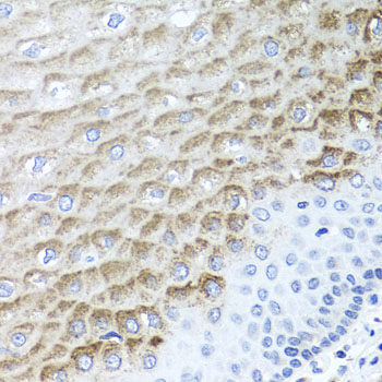 F3 / CD142 / Tissue factor Antibody - Immunohistochemistry of paraffin-embedded human esophagus using F3 Antibodyat dilution of 1:100 (40x lens).