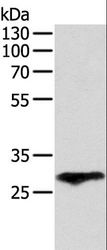 F3 / CD142 / Tissue factor Antibody - Western blot analysis of Human fetal lung tissue, using F3 Polyclonal Antibody at dilution of 1:400.