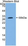 F3 / CD142 / Tissue factor Antibody - Western blot of recombinant TF / Transferrin.