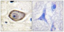 F3 / CD142 / Tissue factor Antibody - Immunohistochemistry analysis of paraffin-embedded human brain, using Coagulation Factor III (Phospho-Ser290) Antibody. The picture on the right is blocked with the phospho peptide.