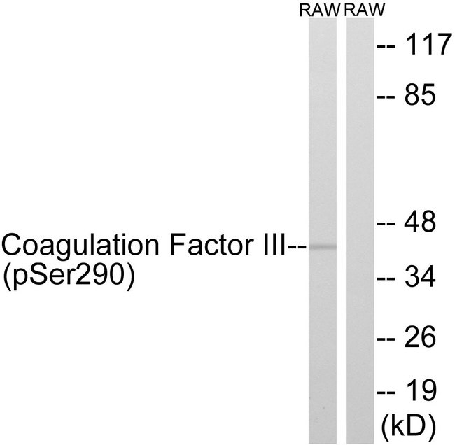F3 / CD142 / Tissue factor Antibody - Western blot analysis of lysates from RAW264.7 cells treated with TNF 20ng/ml 30', using Coagulation Factor III (Phospho-Ser290) Antibody. The lane on the right is blocked with the phospho peptide.
