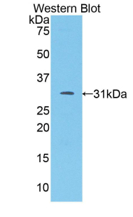 F5 / Factor Va Antibody - Western blot of recombinant F5 / Factor Va.  This image was taken for the unconjugated form of this product. Other forms have not been tested.