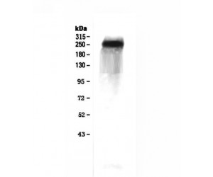 F5 / Factor Va Antibody - Western blot analysis of Factor V using anti-Factor V antibody
