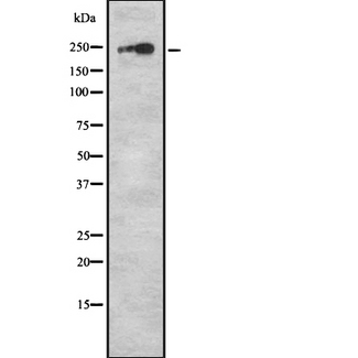 F5 / Factor Va Antibody - Western blot analysis F5 using A549 whole cells lysates