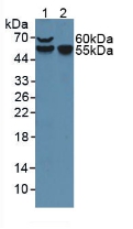 F7 / Factor VII Antibody - Western Blot; Sample: Lane1: Mouse Placenta Tissue; Lane2: Mouse Spleen Tissue.