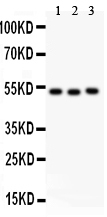 F7 / Factor VII Antibody - anti-Factor VII antibody, Western blotting All lanes: Anti Factor VII at 0.5ug/ml Lane 1: SMMC Whole Cell Lysate at 40ugLane 2: JURKAT Whole Cell Lysate at 40ugLane 3: RAJI Whole Cell Lysate at 40ugPredicted bind size: 52KD Observed bind size: 52KD