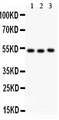 F7 / Factor VII Antibody - anti-Factor VII antibody, Western blotting All lanes: Anti Factor VII at 0.5ug/ml Lane 1: SMMC Whole Cell Lysate at 40ugLane 2: JURKAT Whole Cell Lysate at 40ugLane 3: RAJI Whole Cell Lysate at 40ugPredicted bind size: 52KD Observed bind size: 52KD