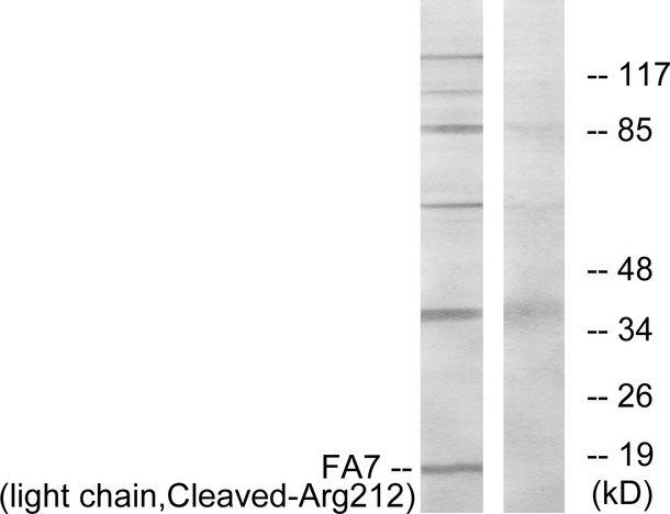 F7 / Factor VII Antibody - Western blot analysis of extracts from Jurkat cells, treated with eto (25uM, 24hours), using FA7 (light chain, Cleaved-Arg212) antibody.