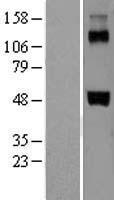 F7 / Factor VII Protein - Western validation with an anti-DDK antibody * L: Control HEK293 lysate R: Over-expression lysate