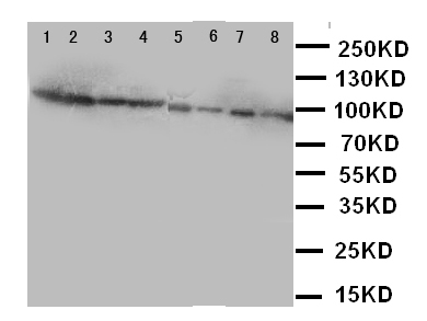 F8 / FVIII / Factor VIII Antibody - WB of F8 / FVIII / Factor VIII antibody. Lane 1: A431 Cell Lysate. Lane 2: HELA Cell Lysate. Lane 3: SMMC Cell Lysate. Lane 4: JURKAT Cell Lysate. Lane 5: RAJI Cell Lysate. Lane 6: CEM Cell Lysate. Lane 7: HL-60 Cell Lysate. Lane 8: MCF-7 Cell Lysate.