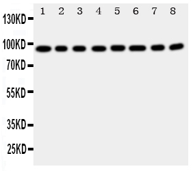F8 / FVIII / Factor VIII Antibody - Anti-Factor VIII antibody, Western blotting Lane 1: A431 Cell LysateLane 2: HELA Cell LysateLane 3: SMMC Cell LysateLane 4: JURKAT Cell LysateLane 5: RAJI Cell LysateLane 6: CEM Cell LysateLane 7: HL-60 Cell LysateLane 8: MCF-7 Cell Lysate