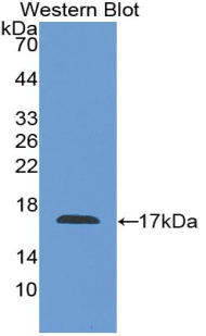 F8 / FVIII / Factor VIII Antibody - Western Blot; Sample: Recombinant protein.