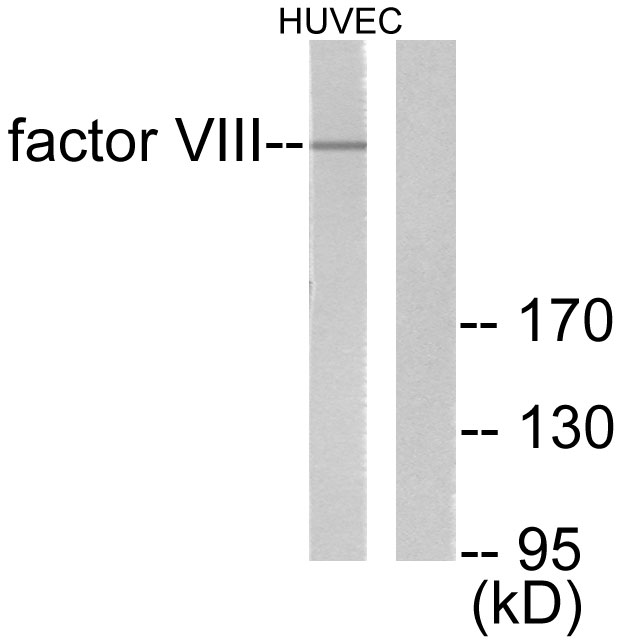 F8 / FVIII / Factor VIII Antibody - Western blot analysis of lysates from HUVEC cells, using Factor VIII Antibody. The lane on the right is blocked with the synthesized peptide.