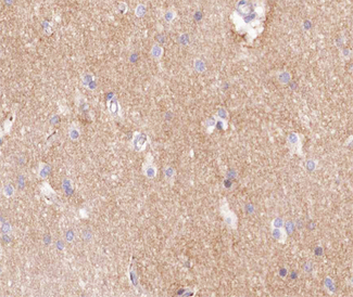 F8 / FVIII / Factor VIII Antibody - 1:100 staining human brain tissue by IHC-P. The tissue was formaldehyde fixed and a heat mediated antigen retrieval step in citrate buffer was performed. The tissue was then blocked and incubated with the antibody for 1.5 hours at 22°C. An HRP conjugated goat anti-rabbit antibody was used as the secondary.